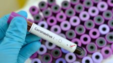 وكالة الصحة الأميركية تؤكد تسجيل 5 إصابات بفيروس كورونا في الولايات المتحدة