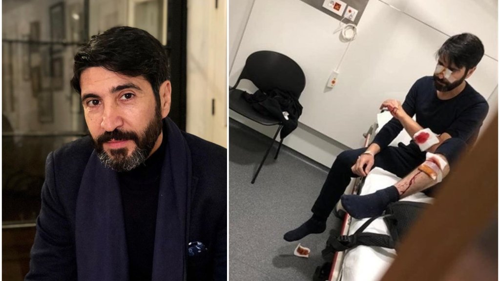 بالصورة/ الفنان اللبناني وسام صباغ يتعرض لحادث سير 