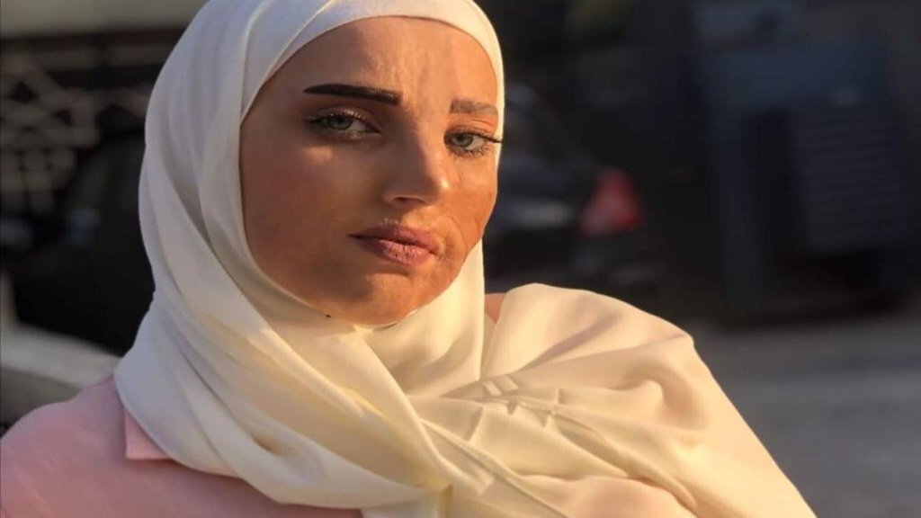 "إسم على مسمى"...أمل التي احترق وجهها باحتراق المنزل حاربت التنمر وقررت العيش كأي فتاة وتحقيق طموحها: "الاختلاف لا يجب ان يقف حاجزًا"!