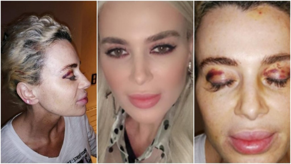 "كارولين" تروي تفاصيل 10 أيام من الرعب عاشتها بعد خطفها من أجل فدية مالية: يدي بقيت مربوطة وهددوني بأولادي