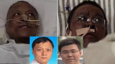 ديلي ميل : طبيبان صينيان كانا يعانيان من فيروس كورونا تحولت بشرتهما إلى اللون القاتم بعد اختلالات هرمونية وتضرر كبداهما