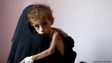 اليونيسف: نقص المساعدات يهدد نحو 2.4 مليون طفل يمني بالمجاعة