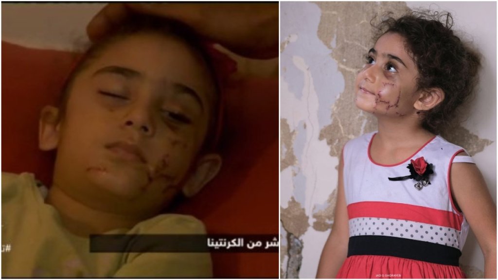 بالفيديو/ عن يارا الصغيرة.. والدها يروي ما حصل معها خلال فاجعة إنفجار مرفأ بيروت