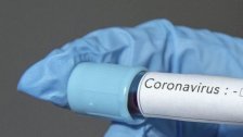 ثبوت حالة واحدة إيجابية في بلدة عدلون واجراء فحوصات ال PCR لـ31 مخالطا