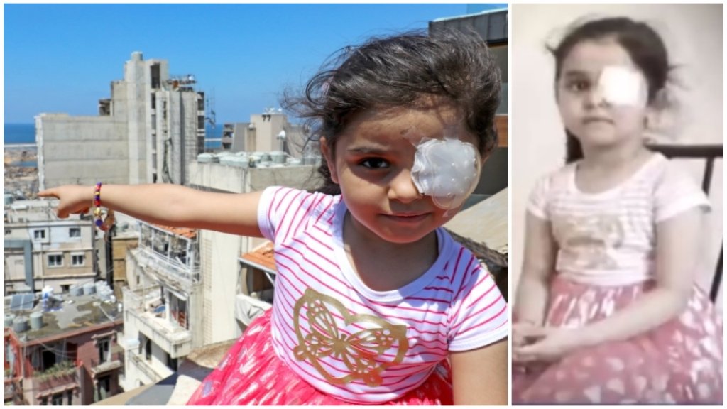 بالفيديو/ "بدّي عيني"...انفجار بيروت كان آخر ما رأته  سما ابنة الخمس سنوات بعينين مبصرتين قبل أن يسرق إحداهما!