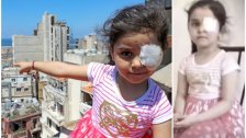 بالفيديو/ "بدّي عيني"...انفجار بيروت كان آخر ما رأته  سما ابنة الخمس سنوات بعينين مبصرتين قبل أن يسرق إحداهما!