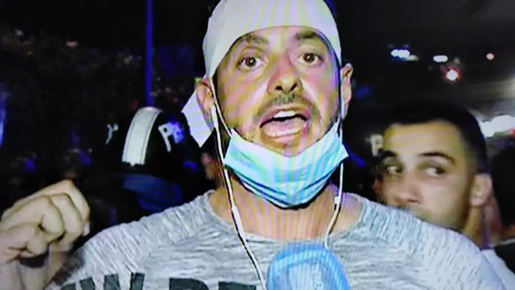 إصابة مراسل الـ LBCI ادمون ساسين برأسه اثناء تغطيته للاحتجاجات على طريق بعبدا