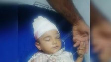 إصابة طفل برصاصة طائشة برأسه في مدينة الميناء
