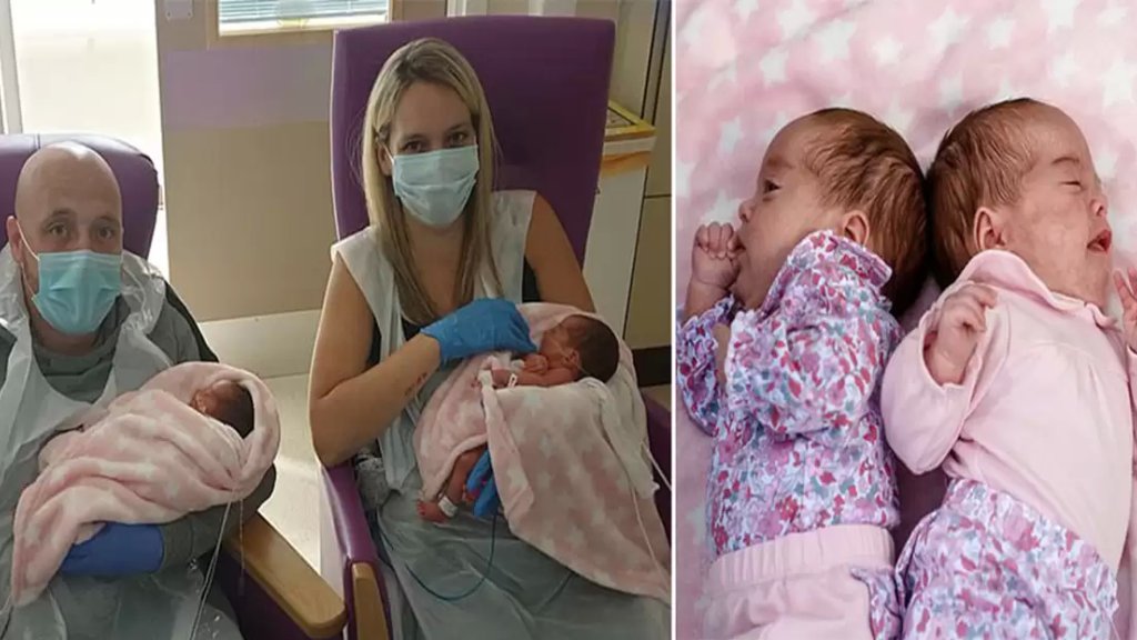 بالصور/ شفاء أول طفلتين توأم بريطانيتين بعد إصابتهما بكورونا داخل الرحم