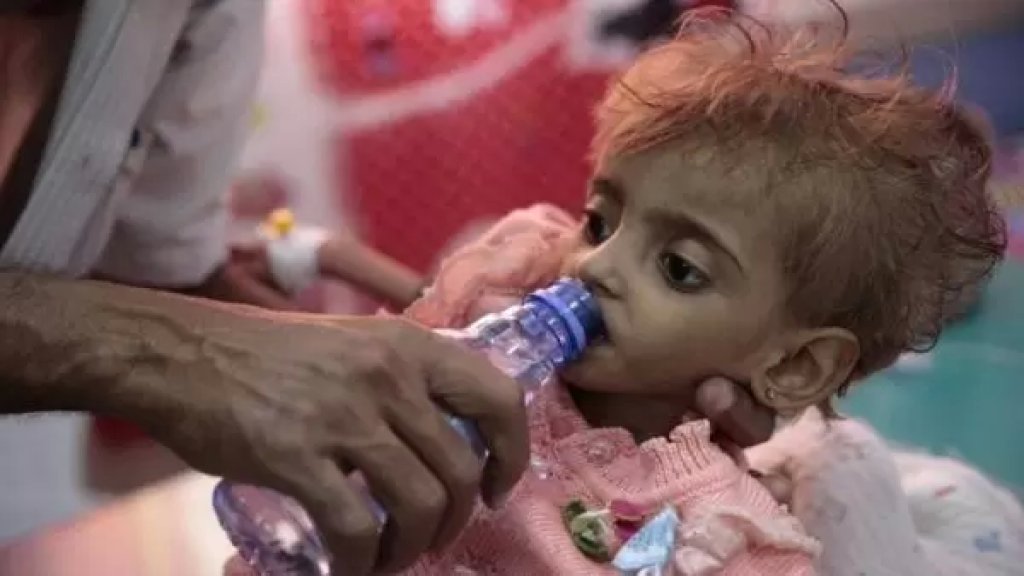 الأمم المتحدة تحذر:  ملايين الأشخاص في اليمن على &quot;شفير المجاعة&quot; مجددا