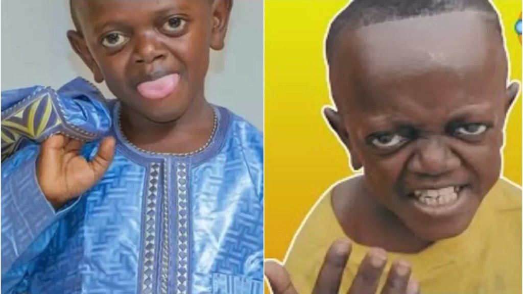 قصة الطفل الإفريقي الشهير: بالحقيقة هو شاب بالـ 20 من العمر يعاني من حالة نادرة من التقزم...وتعرض للسخرية والتنمر بسبب حجمه