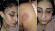 بالصور/ الاعلامي جو معلوف:&quot;رانيا ضحية جديدة من ضحايا العنف.. التقت بطليقها للمطالبة بحقوقها، فانهال عليها بالضرب والإعتداء الوحشي محاولاً قتلها&quot;