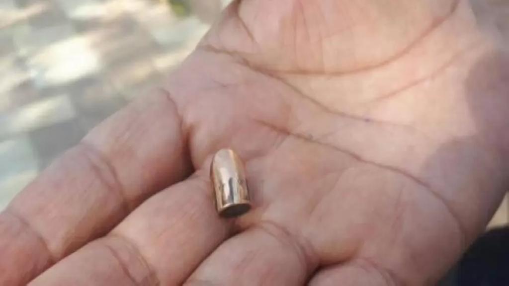 إبن الـ12 عاماً أُصيب بطلق ناري في رأسه عن طريق الخطأ داخل منزله في عكار