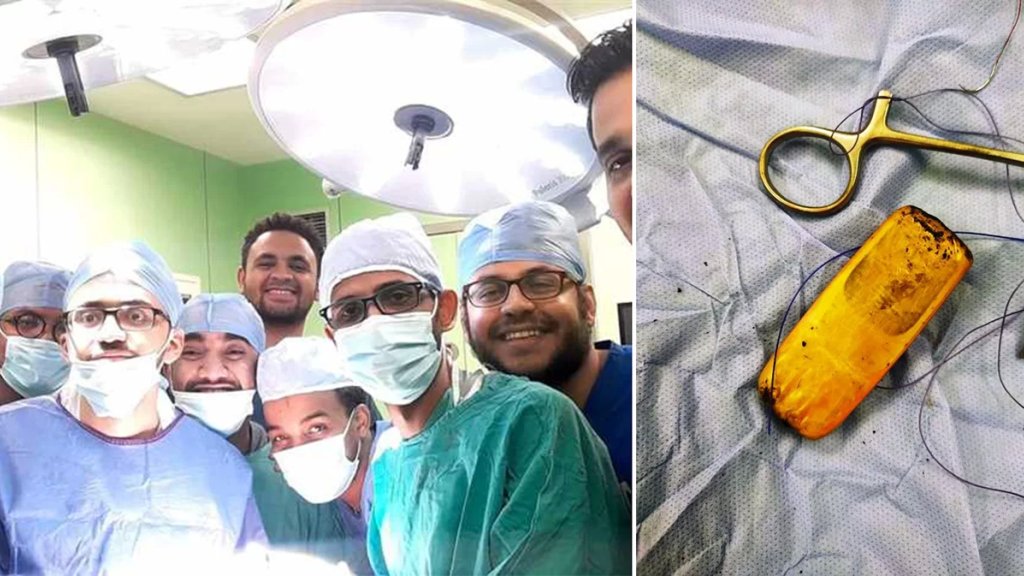 بالصور/ أغرب عملية لأطباء استخرجوا هاتف مريض من معدته في مصر بعدما ابتلعه قبل 6 أشهر!