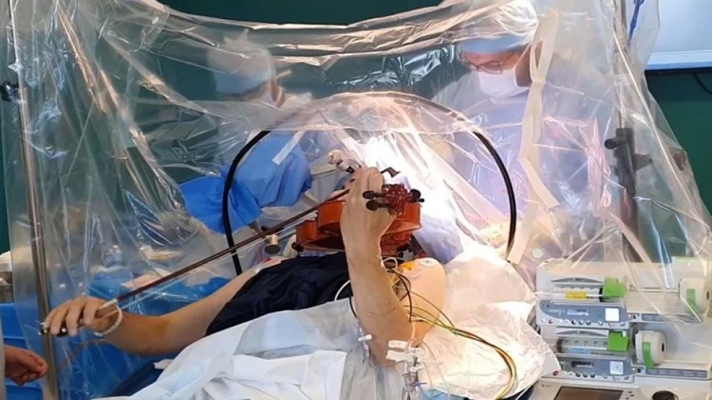 بالفيديو/ طبيب لبناني يجري عملية دقيقة لإزالة ورم من دماغ مريض وهو يعزف على الكمان في إحدى المستشفيات الفرنسية
