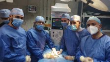 نجاح عملية فصل توأم غير مكتمل النمو بجراحة نادرة في مصر
