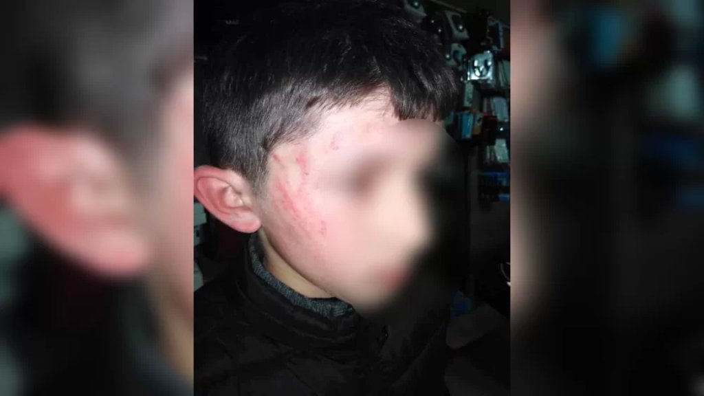 طفل يتعرض للضرب والتعذيب في الغازية والعائلة: نضع ما حصل بين يدي الرأي العام اللبناني