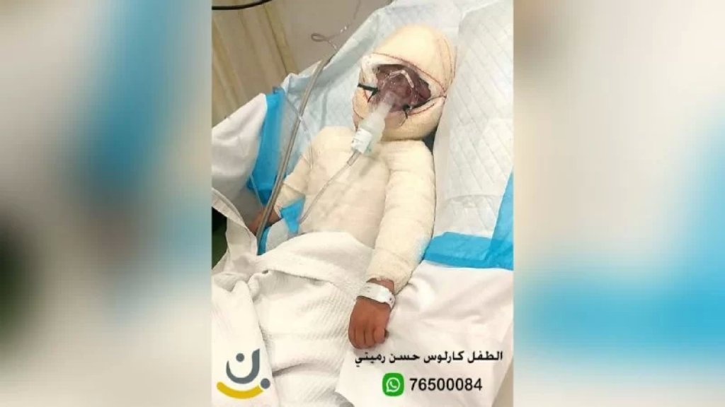  ابن الـ3 سنوات &quot;كارلوس&quot; بحاجة لمساعدتكم... أُصيب بحروق بليغة جداً وعلاجه يتطلب أكثر من 300 مليون ليرة!