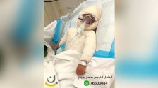 ابن الـ3 سنوات &quot;كارلوس&quot; بحاجة لمساعدتكم... أُصيب بحروق بليغة جداً وعلاجه يتطلب أكثر من 300 مليون ليرة!