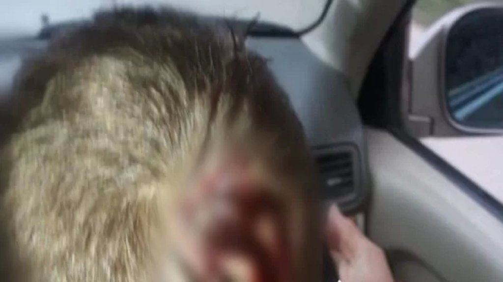 إصابة طفل في بطرماز - الضنية نتيجة رصاص طائش جراء الاحتفال بنتائج الانتخابات
