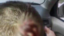 إصابة طفل في بطرماز - الضنية نتيجة رصاص طائش جراء الاحتفال بنتائج الانتخابات