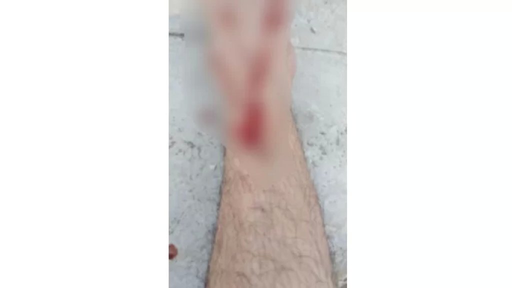 برصاصة طائشة.. إصابة مواطن بطلق ناري في قدمه &quot;خلال مناسبة إجتماعية&quot; في وادي خالد