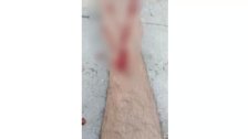 برصاصة طائشة.. إصابة مواطن بطلق ناري في قدمه &quot;خلال مناسبة إجتماعية&quot; في وادي خالد