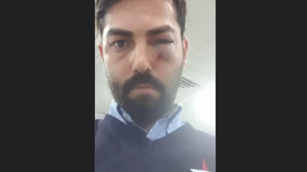  أثناء عودته من عمله... تعرّض مواطن لمحاولة سرقة على طريق قصقص!