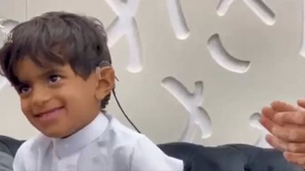 بالفيديو/ بعد خضوعة لعملية زراعة قوقعة.... ضحكات طفل يسمع لأول مرة في حياته تخطف القلوب