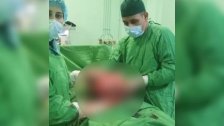 فريق طبي ينجح في استئصال كتلة وزنها 6 كلغ من رحم فتاة بعمر 21 عامًا في بعلبك