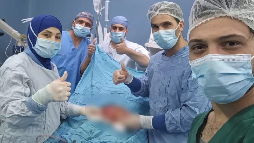 توازي ثلث وزن المريضة.. استئصال كتلة ضخمة من بطن طفلة في مستشفى بعلبك الحكومي!