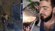 بالصور والفيديو/ مرض جلديّ تفشّى بين عدد من السجناء في سجن رومية.. وقوى الأمن عملت على إسعاف السّجين &quot;أحمد الحلبي&quot;