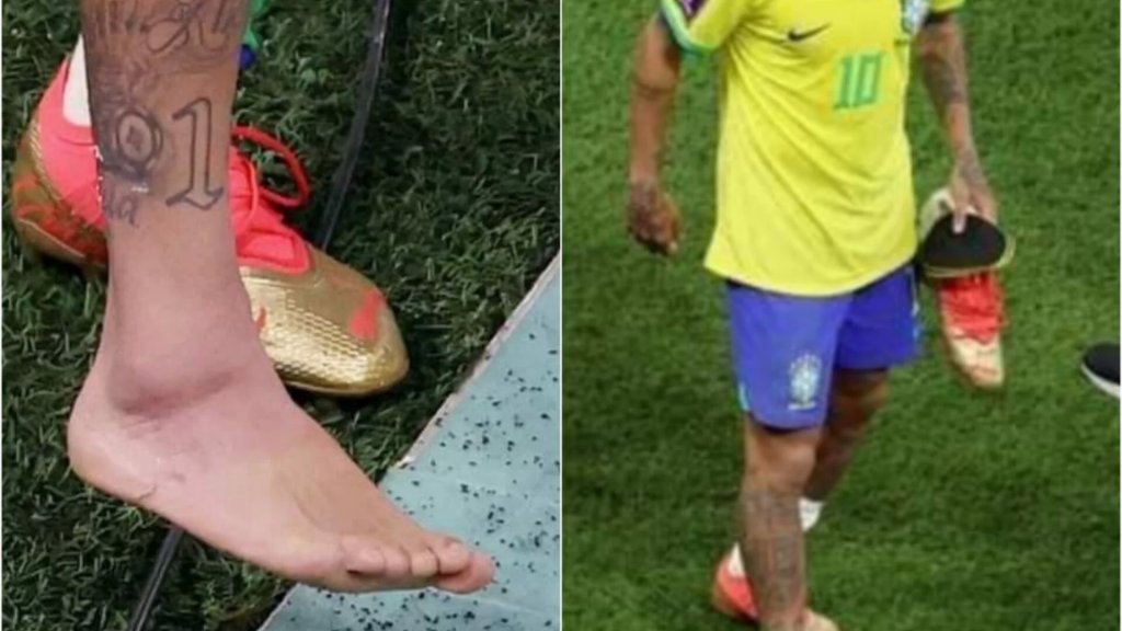 بعد مباراة فوز منتخب البرازيل على صربيا .. لقطات تظهر إصابة نيمار في الكاحل 