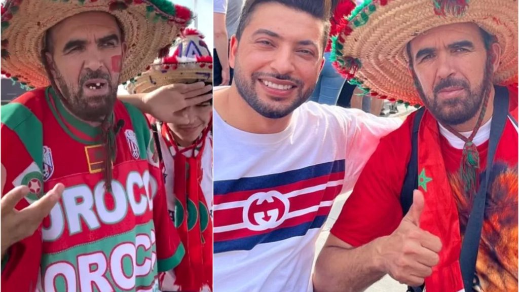 &quot;أبشر وأنا أخوك&quot;.. طبيب أردني يتبرع بصنع ابتسامة مشجع مغربي تعرض للسخرية خلال كأس العالم