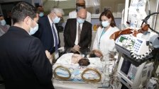 انجاز طبي في الجامعة الأميركية... نجاح العملية الجراحية الأولى من نوعها في لبنان لفصل التوأم رهام وريم!