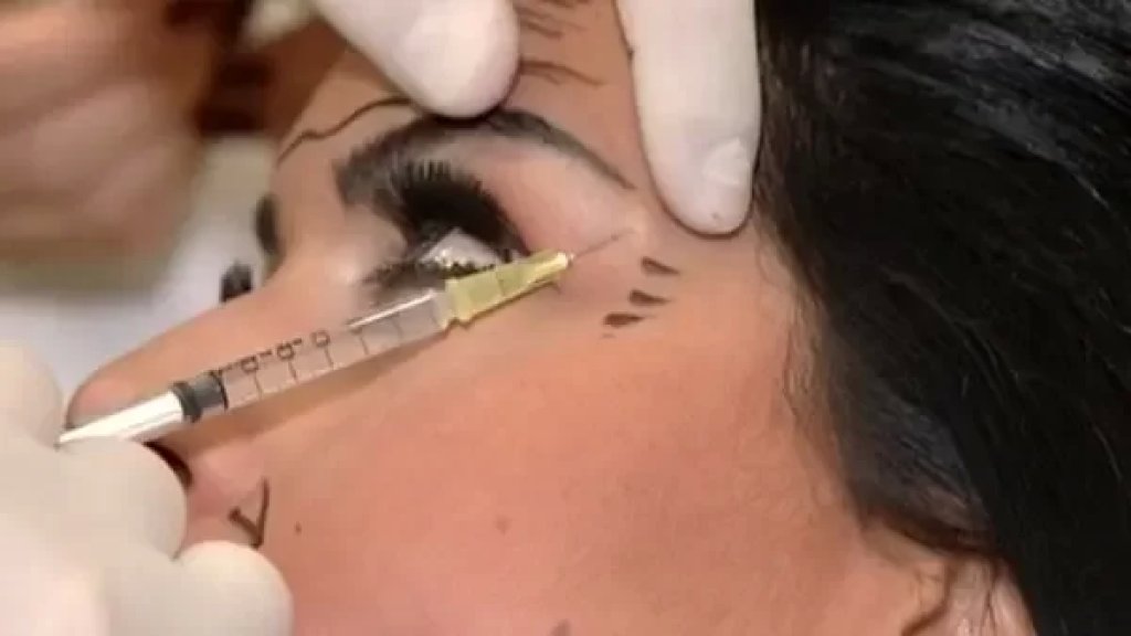 امرأة لا تحمل شهادات تُجري عمليات تجميل في شقة في أبوسمرا !