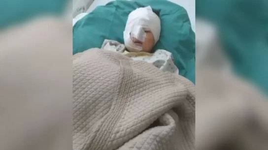 بالفيديو/ الطفل الثاني الذي هاجمه الكلب الشارد في مخيم الرشيدية بخير وهو يتلقى العلاج في المستشفى