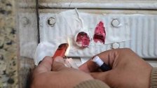 وزارة الصحة اقفلت باتيسري في كليمنصو بالشمع الأحمر لتسببها بحالات تسمم