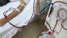 بشرى لمرضى غسيل الكلى