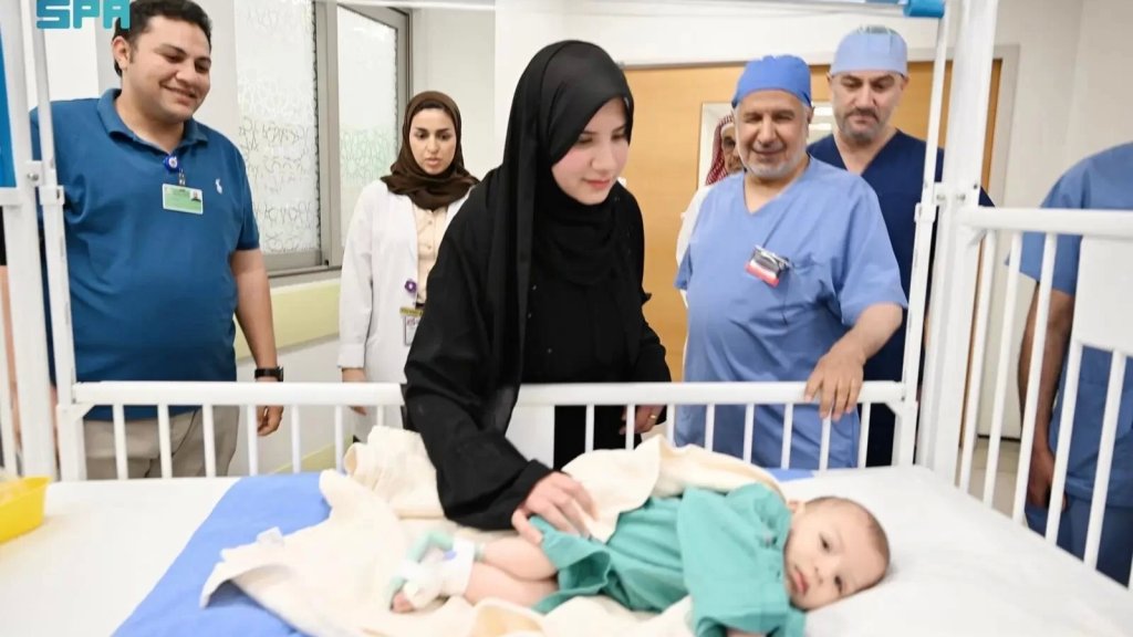 بوقت قياسي.. انتهاء عملية فصل توأم طفيلي مصري بنجاح!