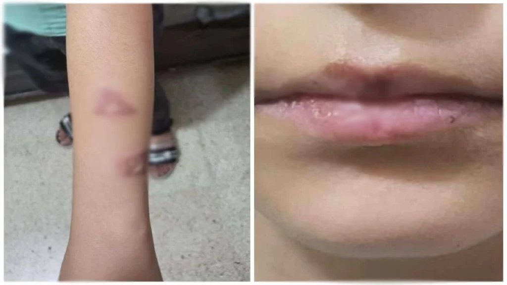 جريمة مروّعة في البقاع: عنّفت أطفال زوجها وحرقت ابنته بسكين&hellip; بتواطؤ من الزوج!