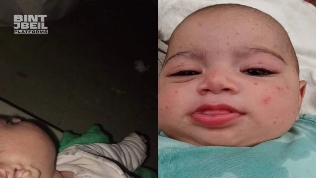 ابنةُ الشهرين ونصف بحاجة إلى علاجٍ يومي&hellip; نداءٌ إنسانيٌّ عاجل!